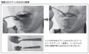 食事を介助するための基本【作業療法士的】