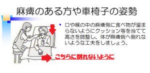 麻痺がある場合の食事介助とは？